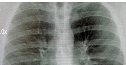 558089894 1216288533864926 3651152478778200568 n (1)