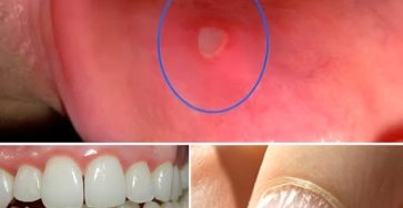 494962070 122167042994480977 5067374892750024477 n