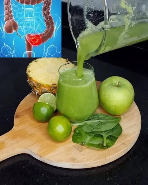 497499557 1103174715180436 8006081253929657649 n 1 819x1024 45