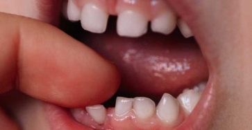 558887524 122147702672412810 1521909511615966012 n