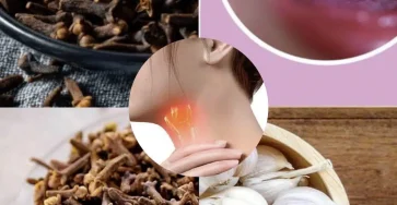 Les clous de girofle pour soulager les maux de gorge un moyen naturel dapaiser linflammation et de favoriser la guerison.jpg