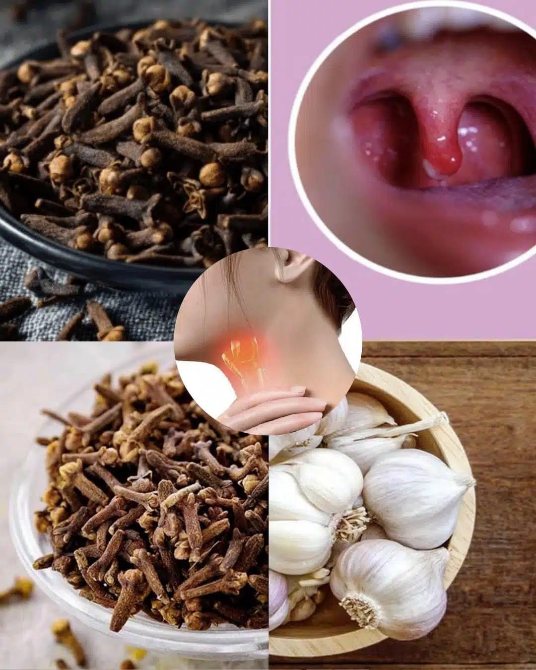 Les clous de girofle pour soulager les maux de gorge un moyen naturel dapaiser linflammation et de favoriser la guerison.jpg