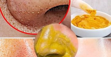 614049524 122158054136858449 1281990992788036971 n