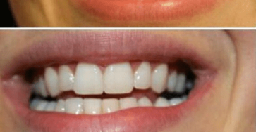 Translated image sv 2026 02 15T185947.719 1