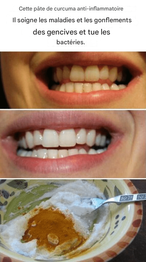 Translated image sv 2026 02 15T185947.719 1