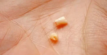 Pourquoi faut il conserver les dents de lait de bebe.jpg