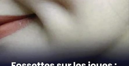 Fossettes sur la joue pourquoi certaines personnes en ont et dautres non 901x1024