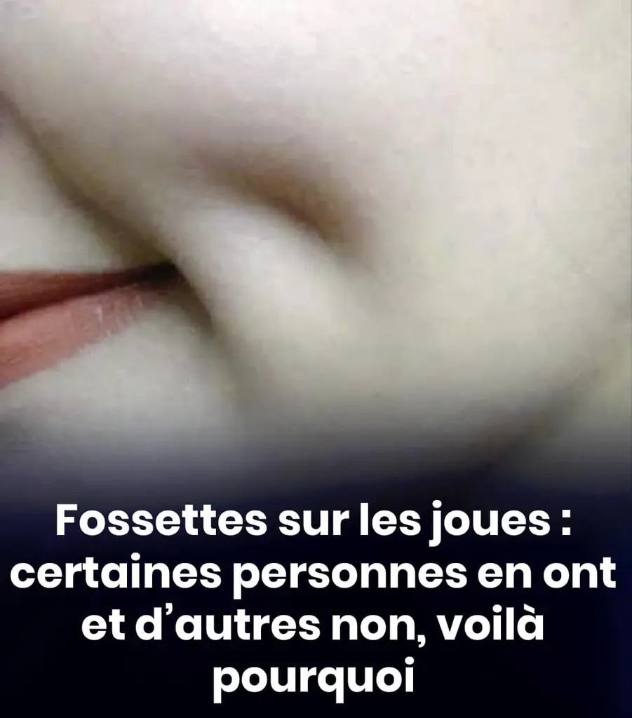 Fossettes sur la joue pourquoi certaines personnes en ont et dautres non 901x1024