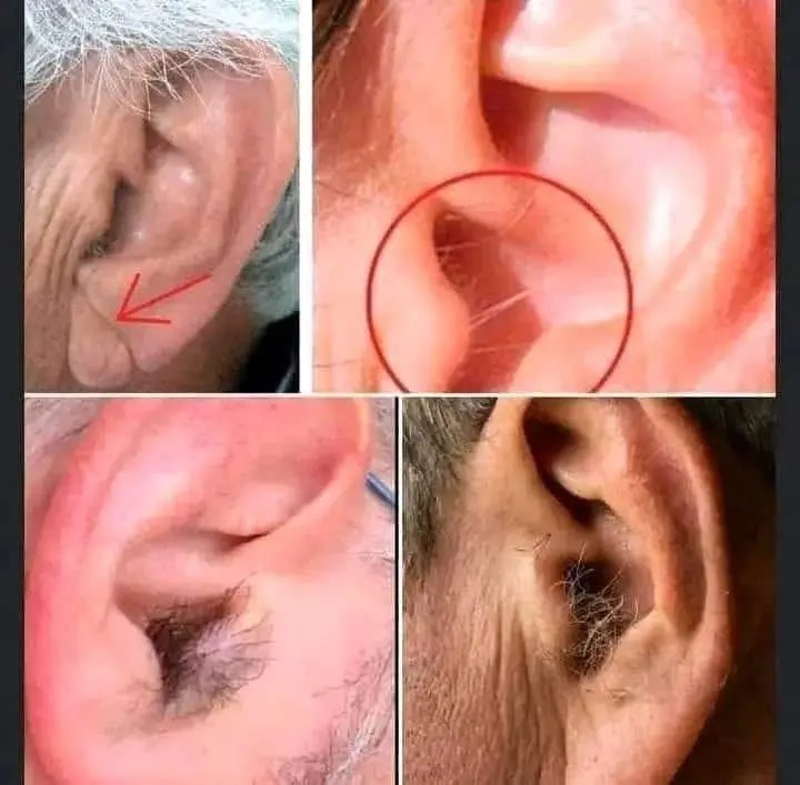Pourquoi trouve t on des poils dans les oreilles