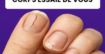 Voici 8 signes que vos ongles vous envoient a propos de votre sante.jpg