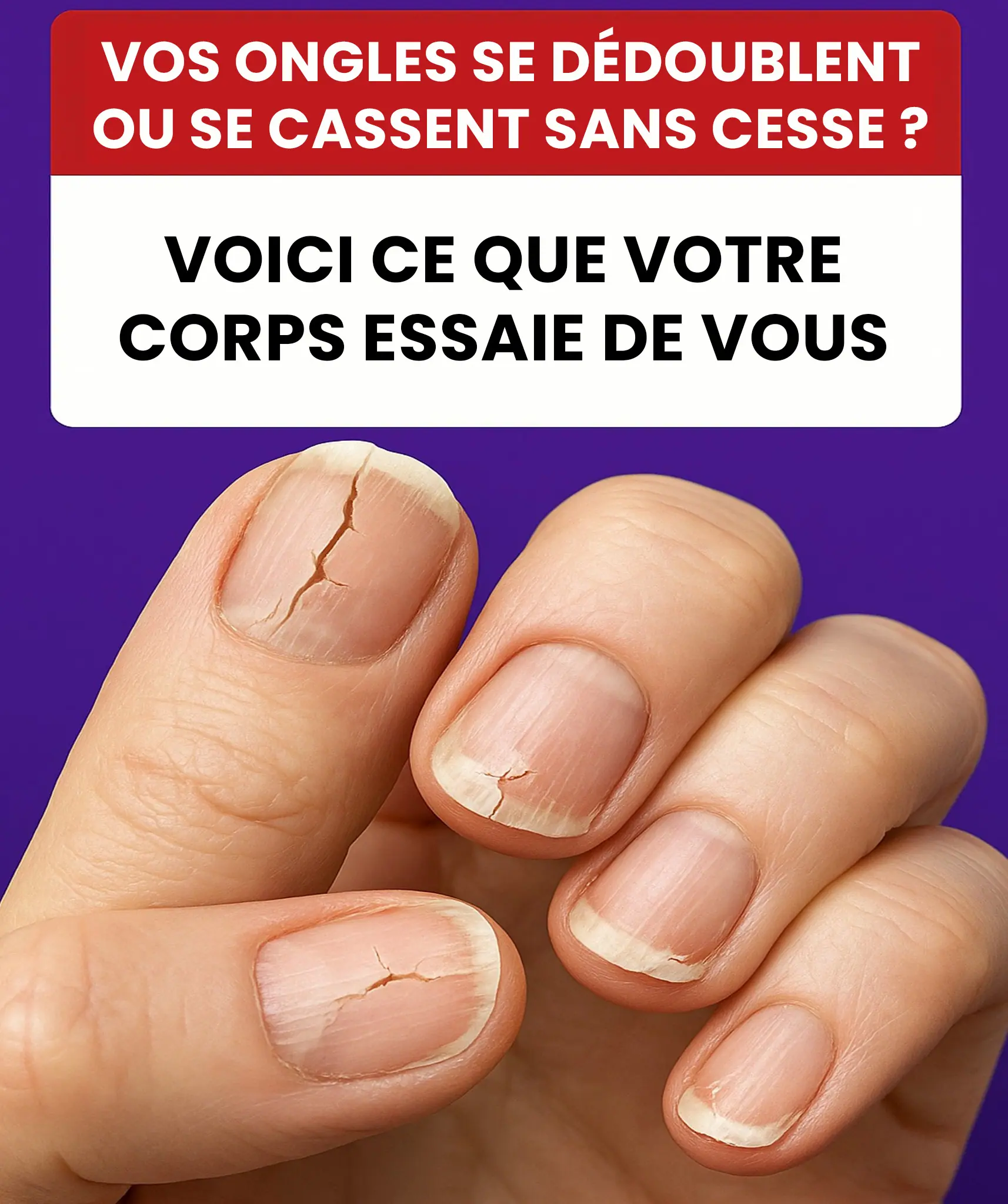 Voici 8 signes que vos ongles vous envoient a propos de votre sante.jpg