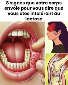 8 signes que votre corps pourrait vous indiquer que vous etes intolerant au lactose.jpg