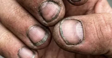 Comment appelle t on une personne qui a des ongles comme ca.jpg