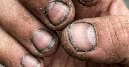 Comment appelle t on une personne qui a des ongles comme ca.jpg