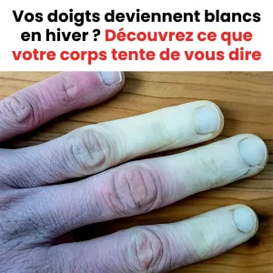 Que faire si vos doigts deviennent blancs en hiver.jpg