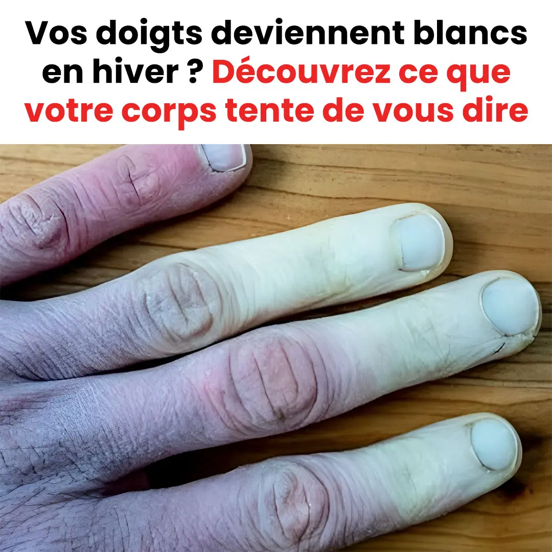 Que faire si vos doigts deviennent blancs en hiver.jpg